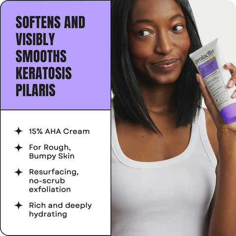AmLactin KP Bumps Be Gone - Therapeutic Body Cream for Keratosis Pilaris - No-Scrub Exfoliator and Body Moisturizer for Dry Skin with 15% Lactic Acid AHA, 3 oz, Pack of 2 (Packaging May Vary)